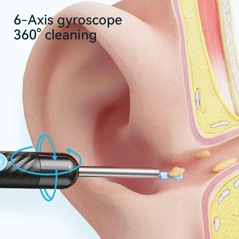 Wireless Ear Wax Removal with Camera Rechargeable Ear Cleaner HD Check Camera with Ear Spoon Set Canal Clean
